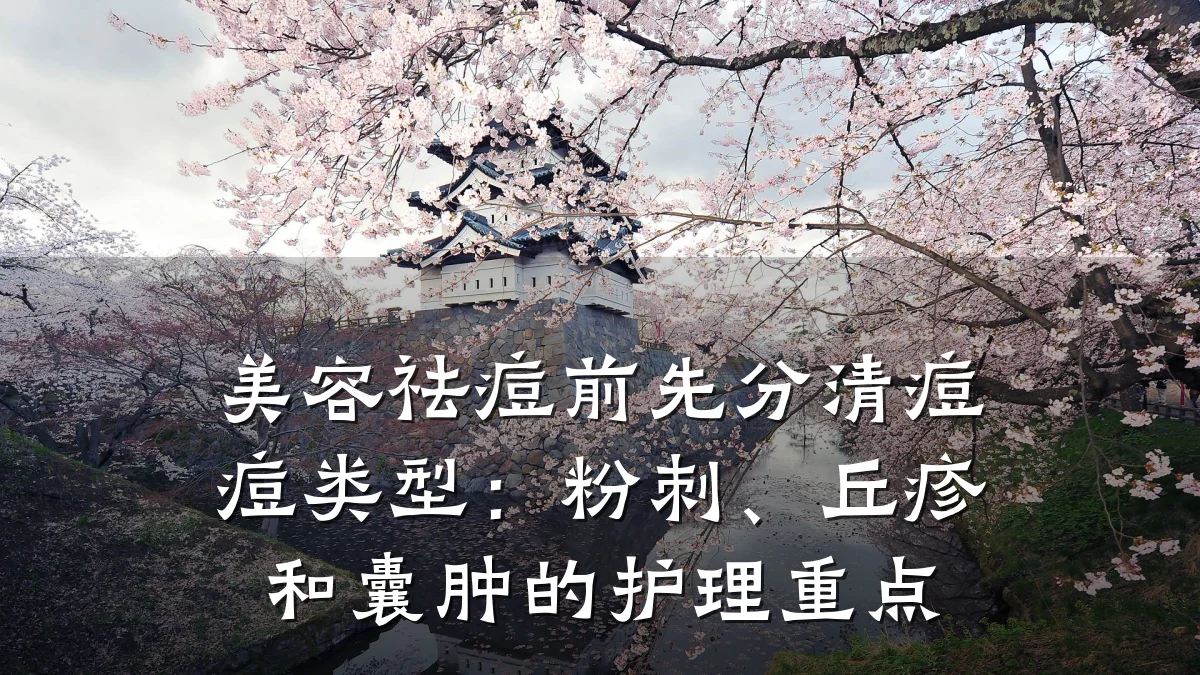 美容祛痘前先分清痘痘类型:粉刺、丘疹和囊肿的护理重点