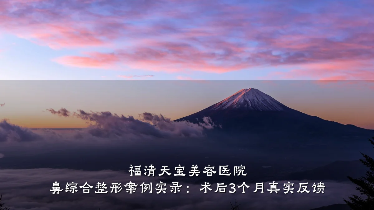 福清天宝美容医院 鼻综合整形案例实录:术后3个月真实反馈