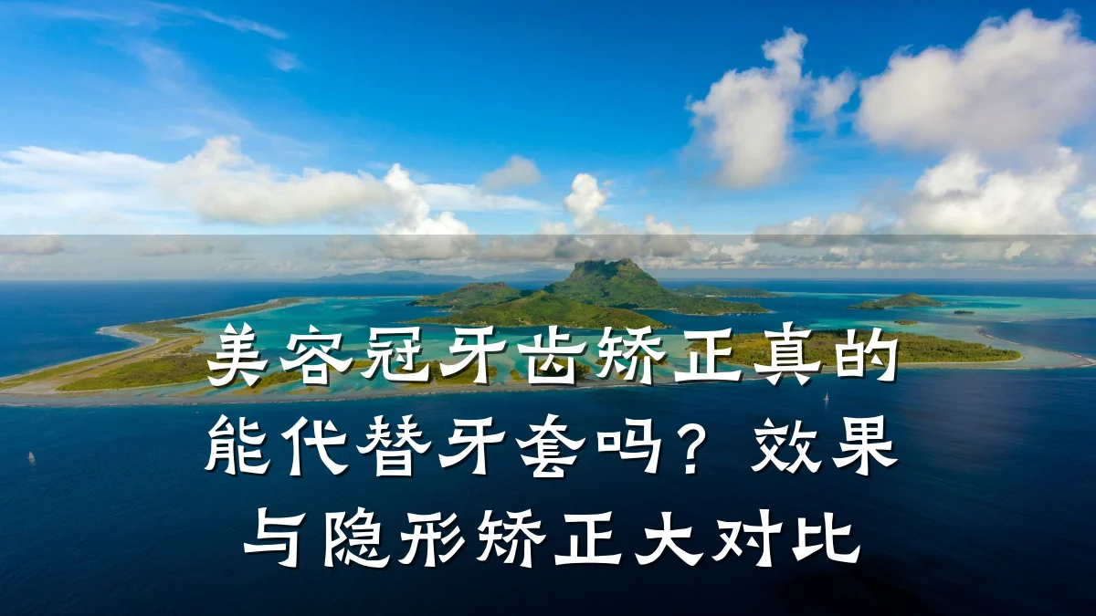 美容冠牙齿矫正真的能代替牙套吗?效果与隐形矫正大对比