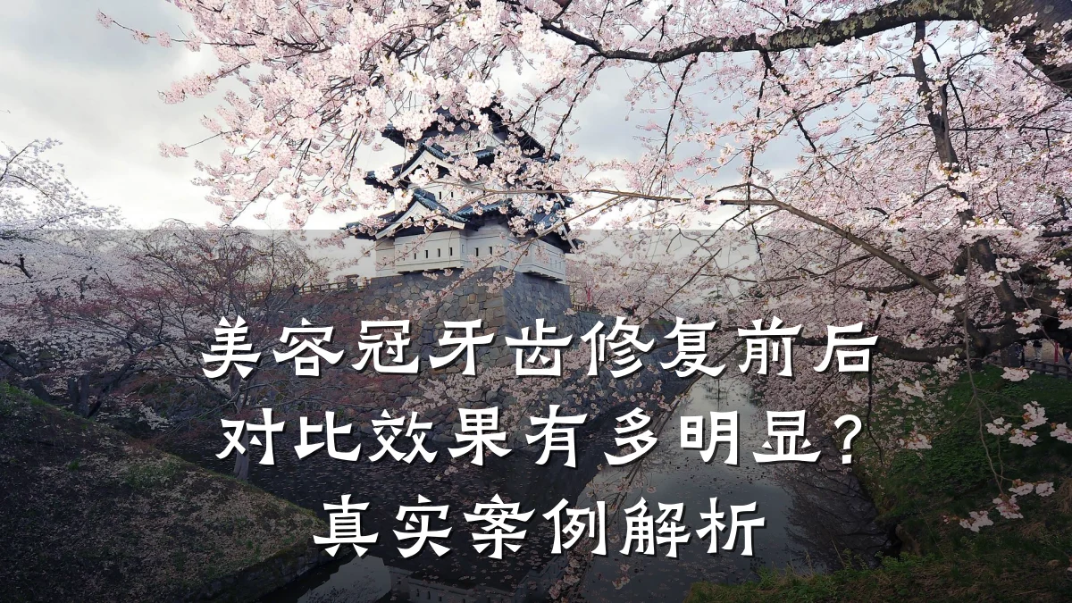 美容冠牙齿修复前后对比效果有多明显?真实案例解析