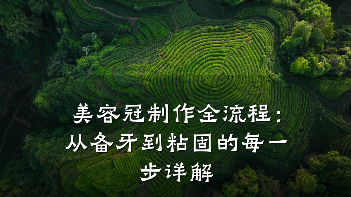 美容冠制作全流程:从备牙到粘固的每一步详解