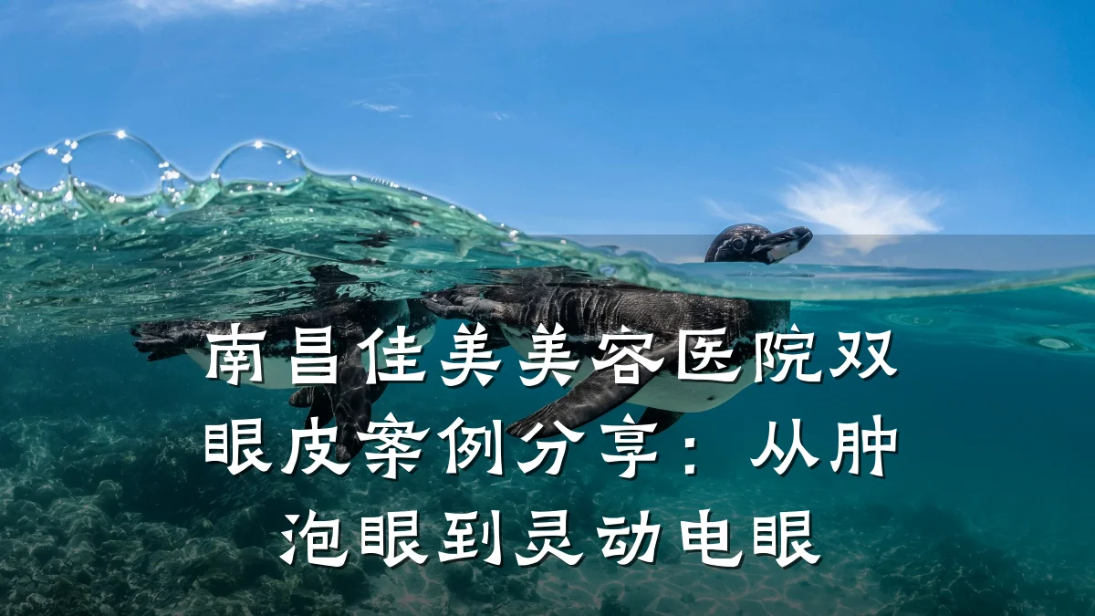 南昌佳美美容医院双眼皮案例分享:从肿泡眼到灵动电眼