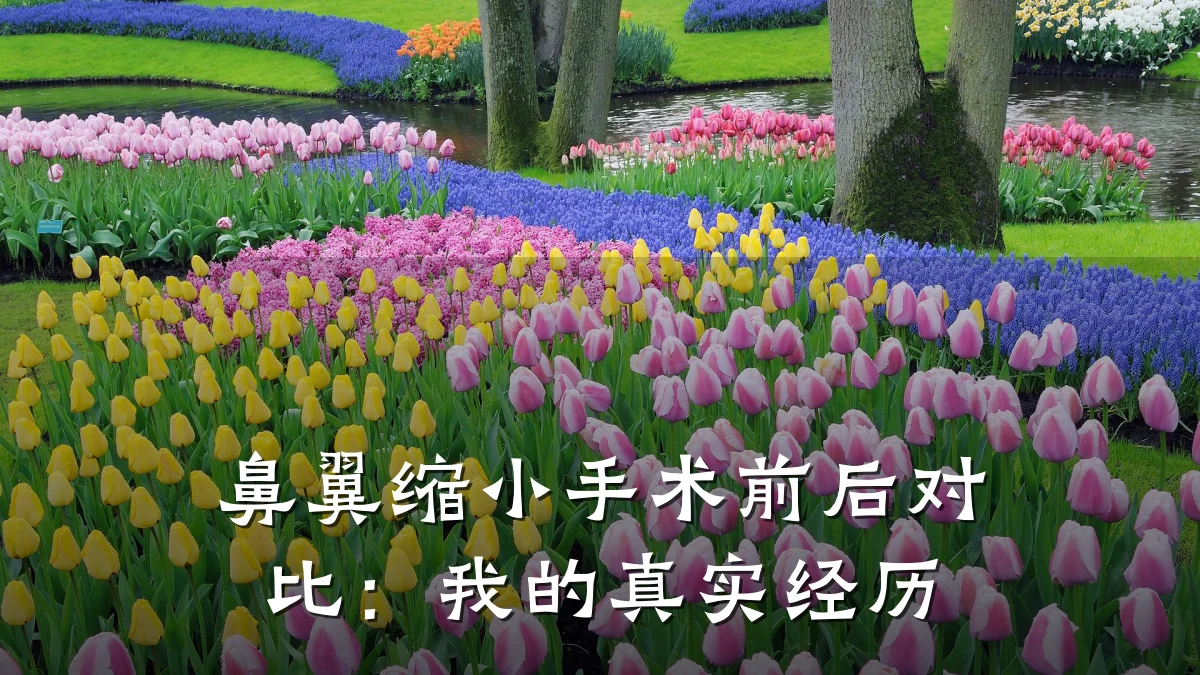 鼻翼缩小手术前后对比：我的真实经历