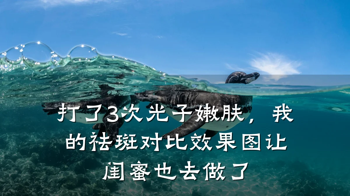 打了3次光子嫩肤，我的祛斑对比效果图让闺蜜也去做了