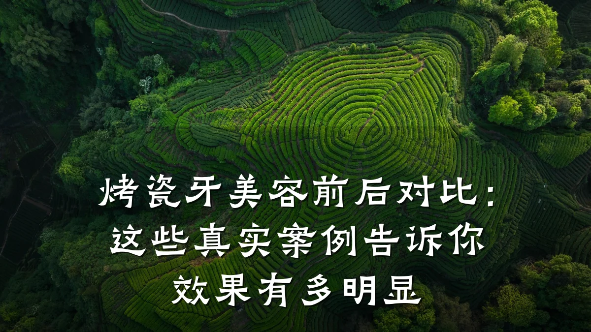 烤瓷牙美容前后对比：这些真实案例告诉你效果有多明显