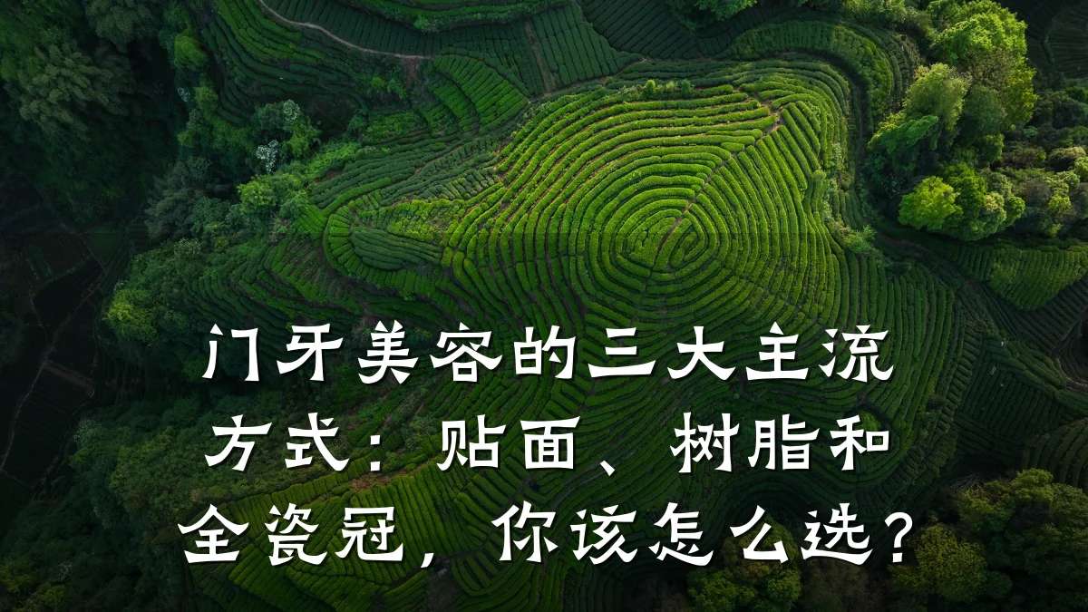 门牙美容的三大主流方式：贴面、树脂和全瓷冠，你该怎么选？