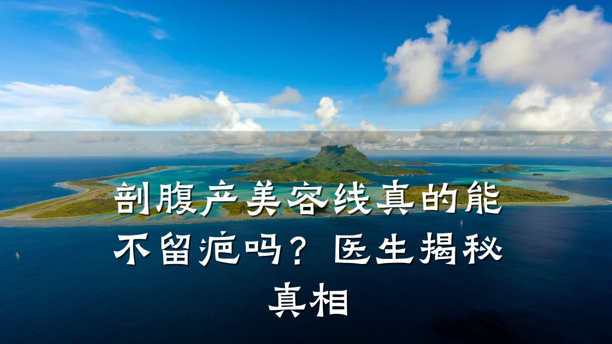 剖腹产美容线真的能不留疤吗?医生揭秘真相
