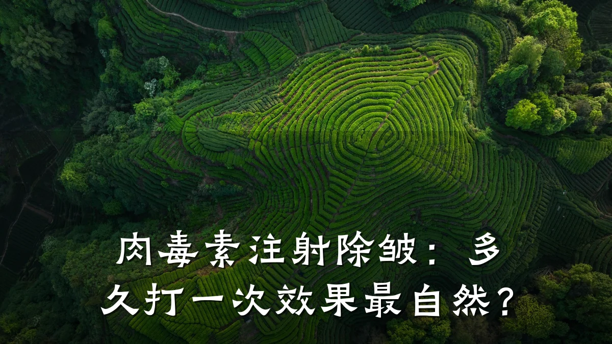 肉毒素注射除皱：多久打一次效果最自然？