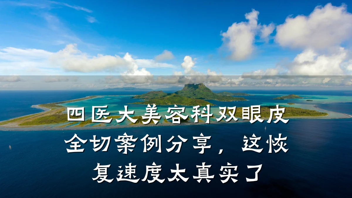 四医大美容科双眼皮全切案例分享，这恢复速度太真实了
