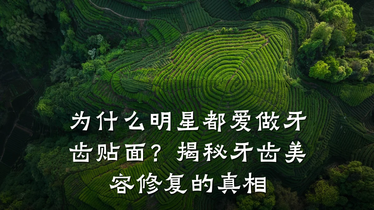 为什么明星都爱做牙齿贴面？揭秘牙齿美容修复的真相