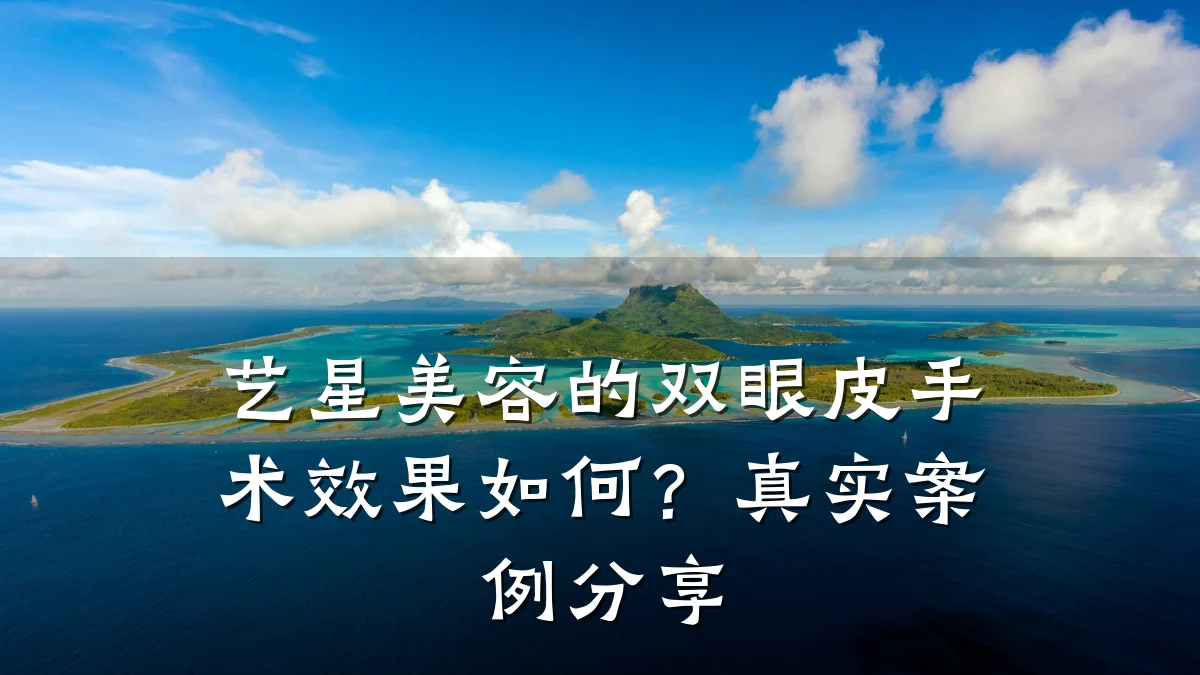 艺星美容的双眼皮手术效果如何?真实案例分享