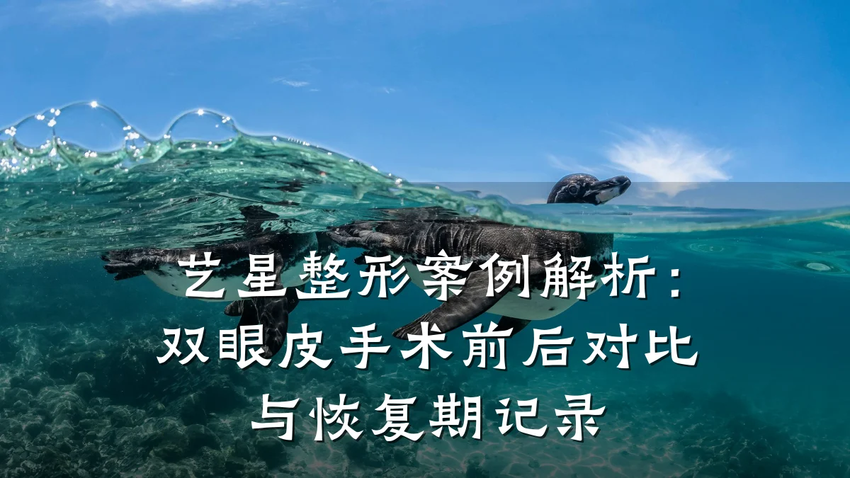 艺星整形案例解析：双眼皮手术前后对比与恢复期记录