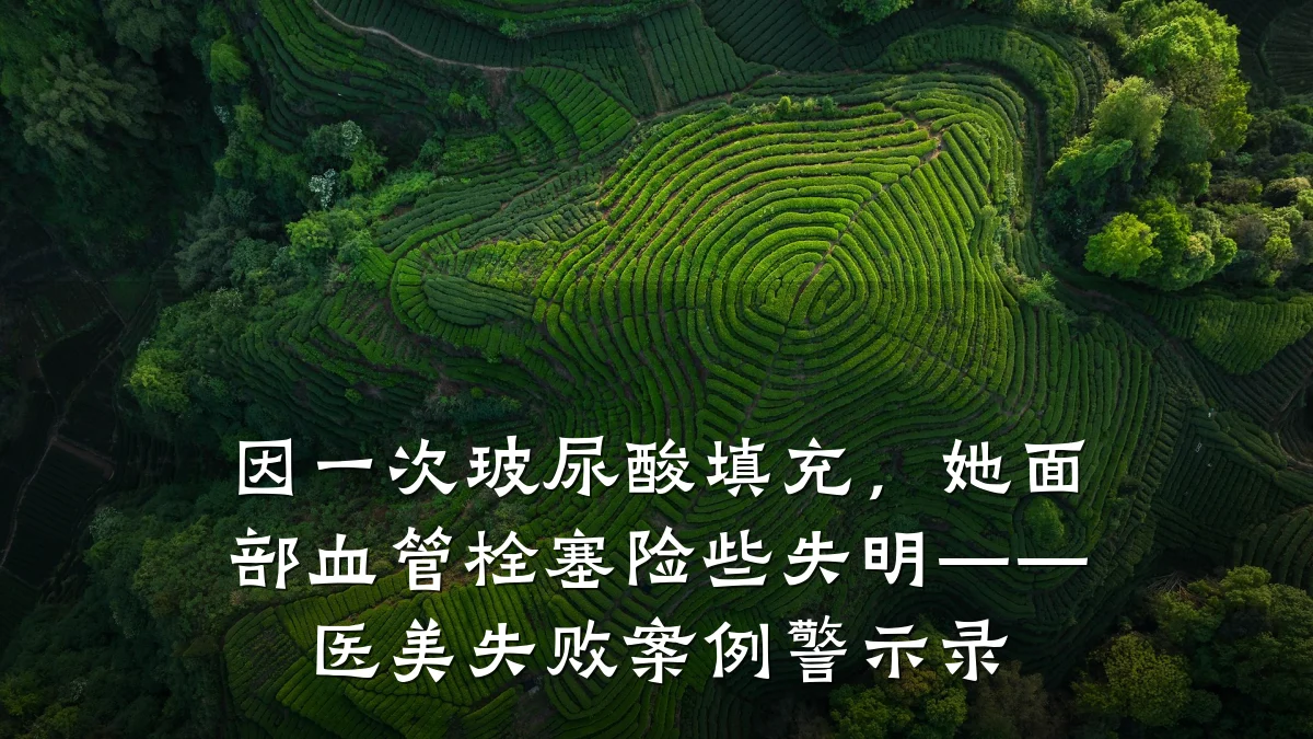 因一次玻尿酸填充，她面部血管栓塞险些失明——医美失败案例警示录