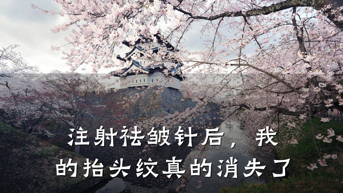 注射祛皱针后，我的抬头纹真的消失了