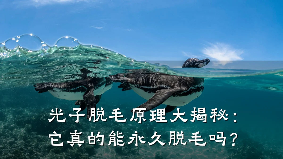光子脱毛原理大揭秘：它真的能永久脱毛吗？