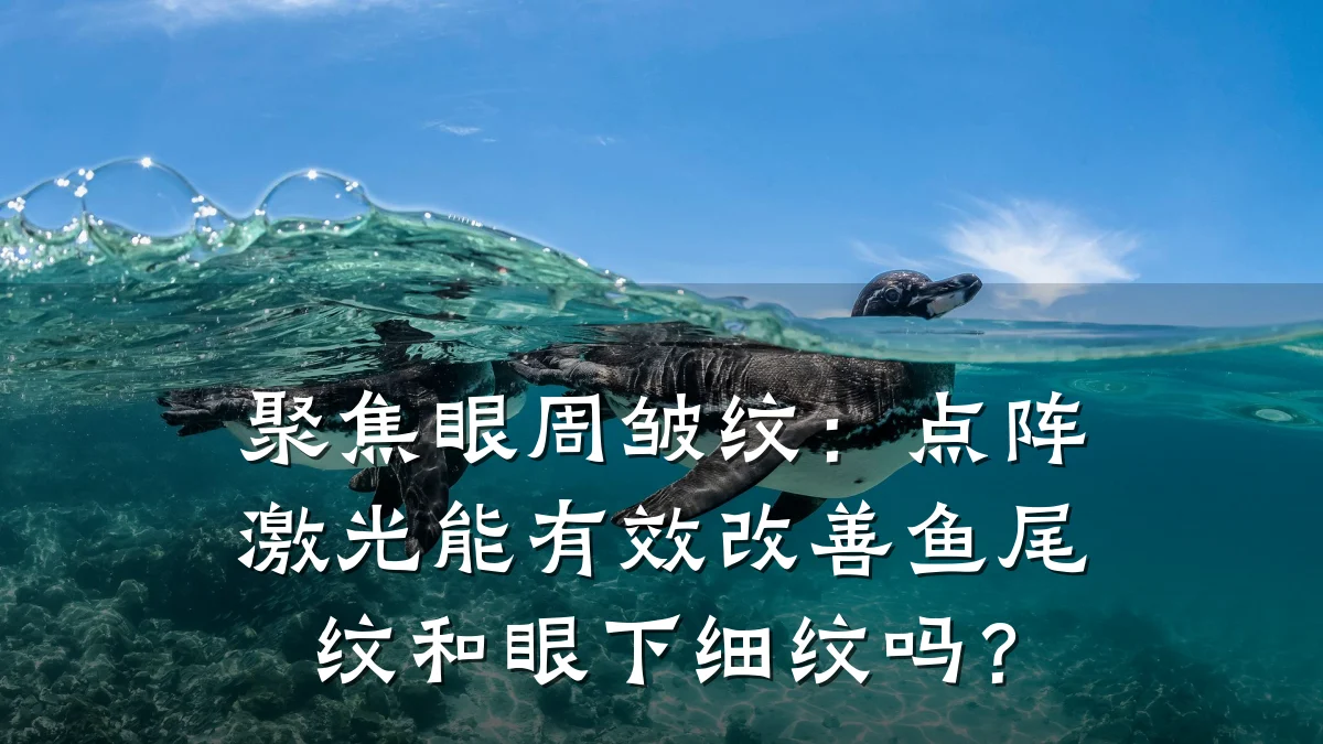 聚焦眼周皱纹：点阵激光能有效改善鱼尾纹和眼下细纹吗？