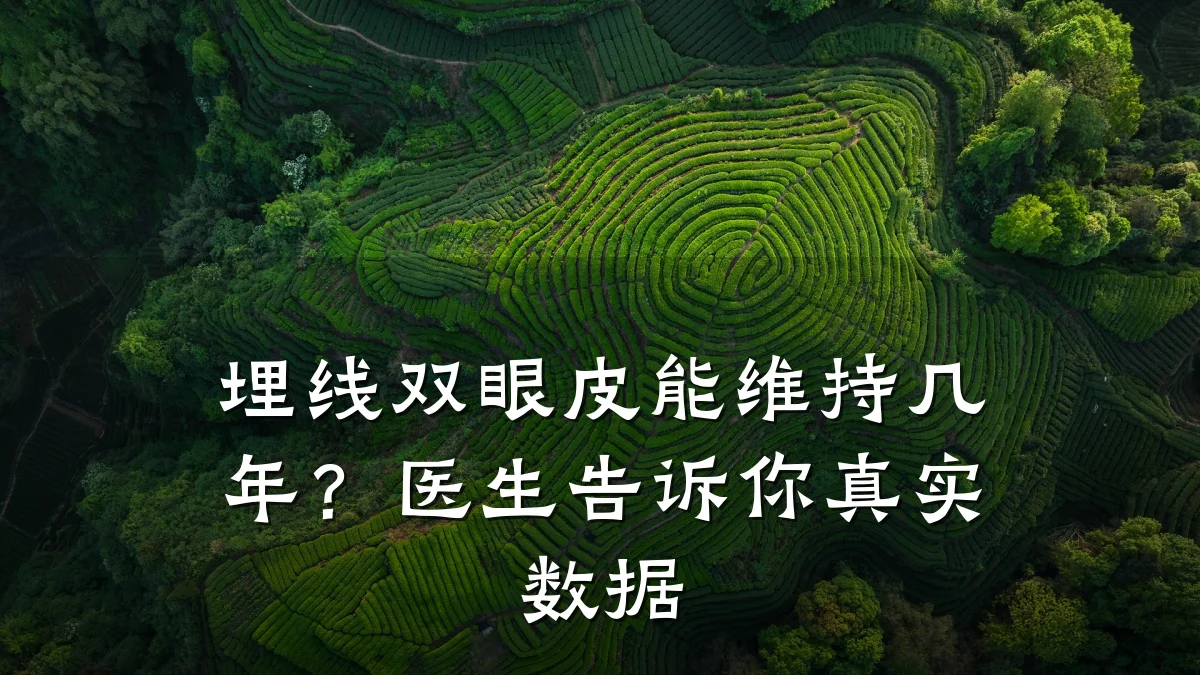 埋线双眼皮能维持几年？医生告诉你真实数据