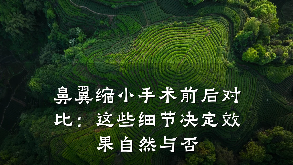 鼻翼缩小手术前后对比：这些细节决定效果自然与否