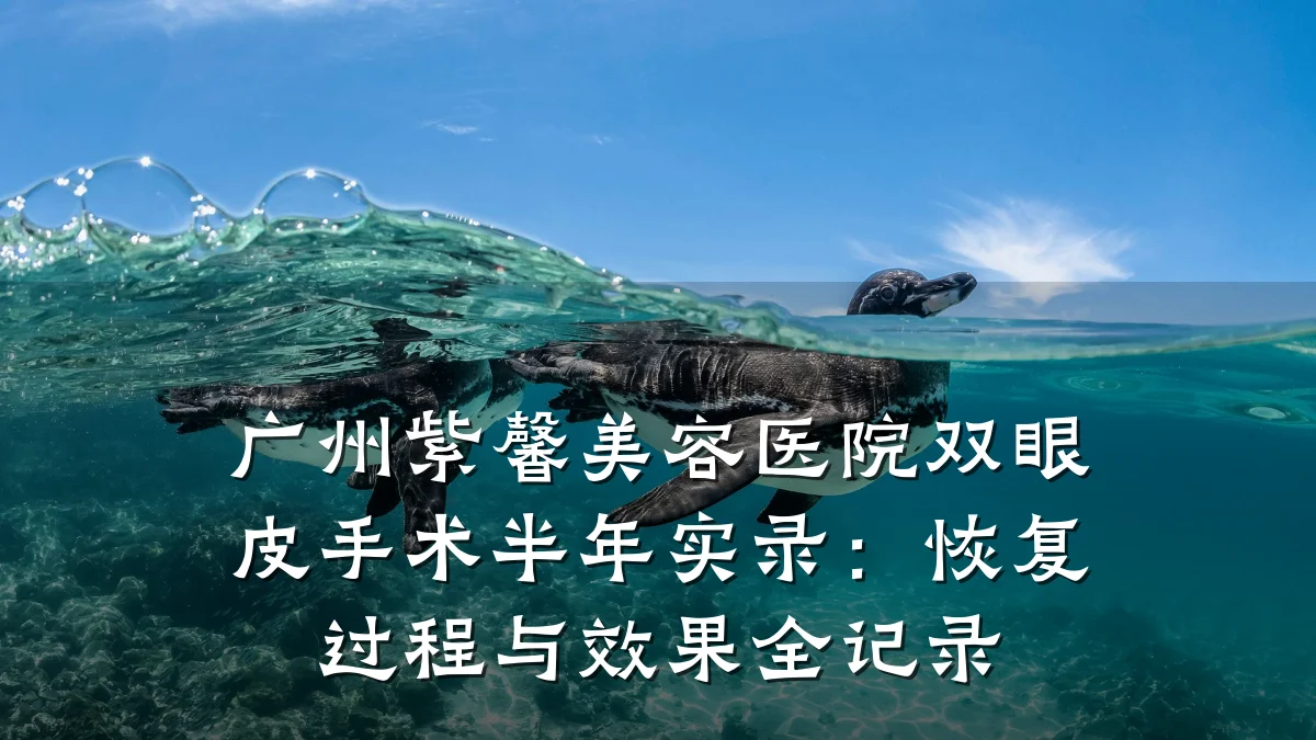 广州紫馨美容医院双眼皮手术半年实录：恢复过程与效果全记录