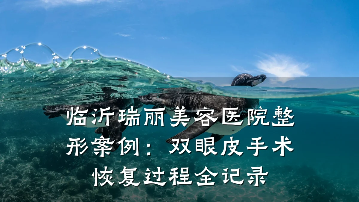 临沂瑞丽美容医院整形案例：双眼皮手术恢复过程全记录