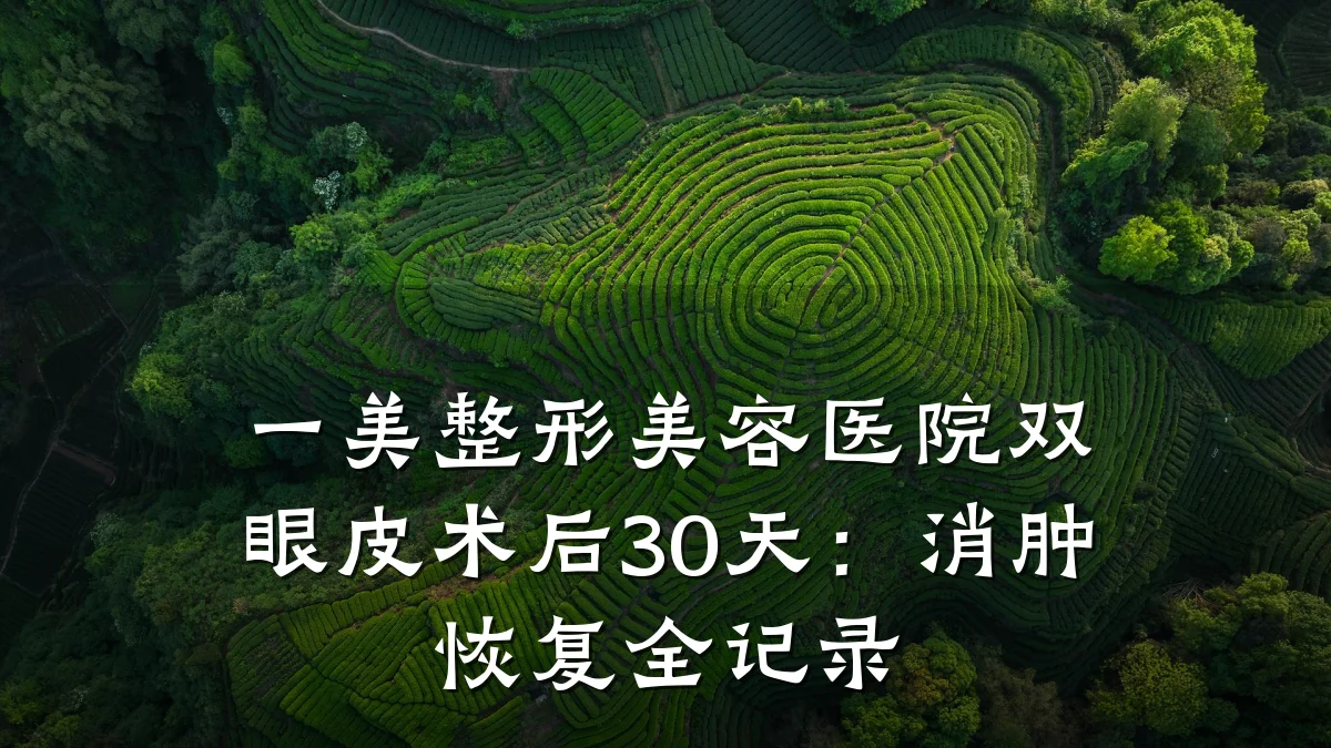 一美整形美容医院双眼皮术后30天：消肿恢复全记录