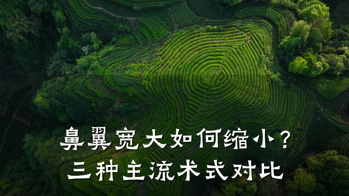 鼻翼宽大如何缩小?三种主流术式对比