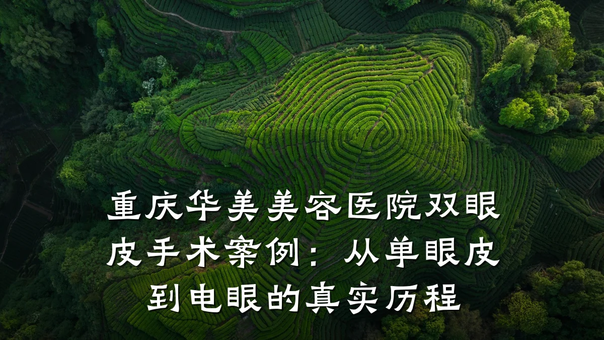 重庆华美美容医院双眼皮手术案例:从单眼皮到电眼的真实历程