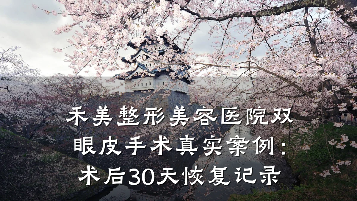 禾美整形美容医院双眼皮手术真实案例:术后30天恢复记录