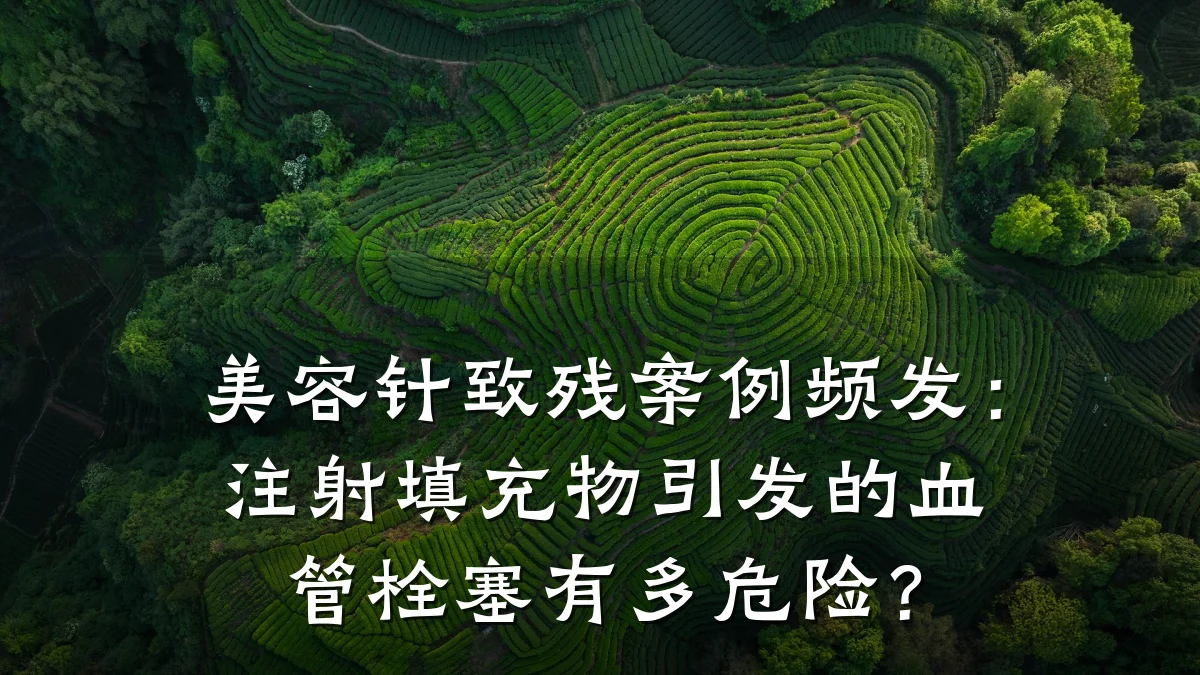 美容针致残案例频发:注射填充物引发的血管栓塞有多危险?