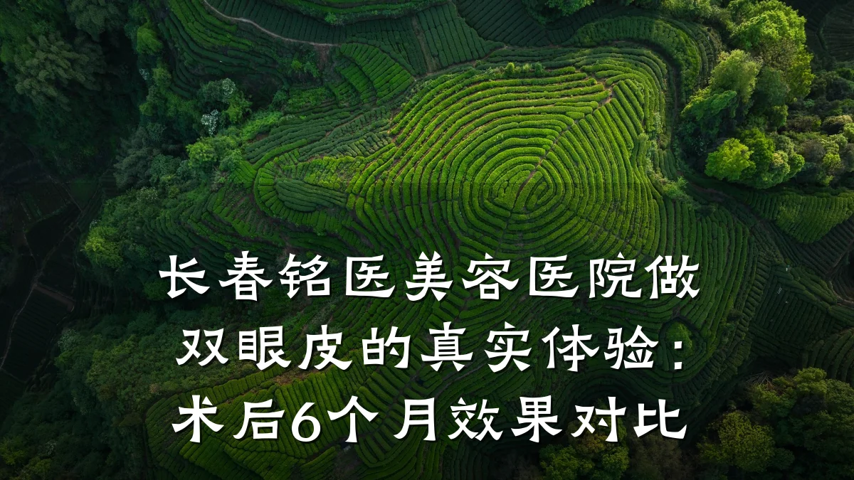长春铭医美容医院做双眼皮的真实体验:术后6个月效果对比