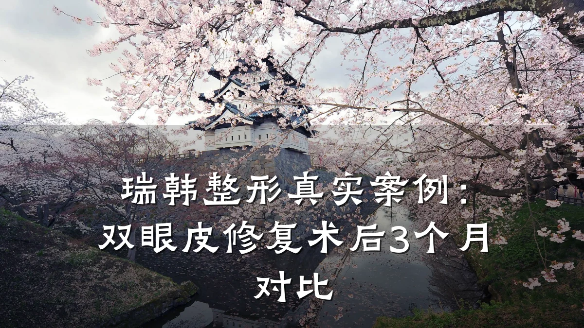 瑞韩整形真实案例:双眼皮修复术后3个月对比